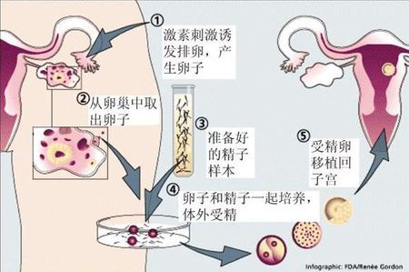 时差培养箱